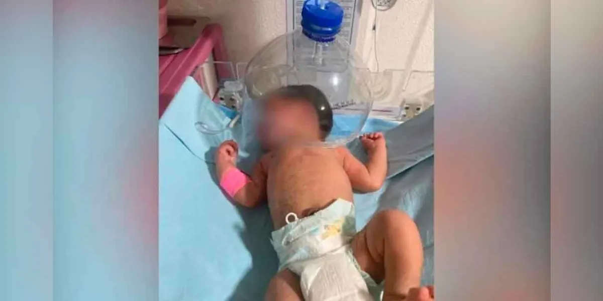Bebé es atendido con botella plástica por falta de insumos en hospital de Tabasco