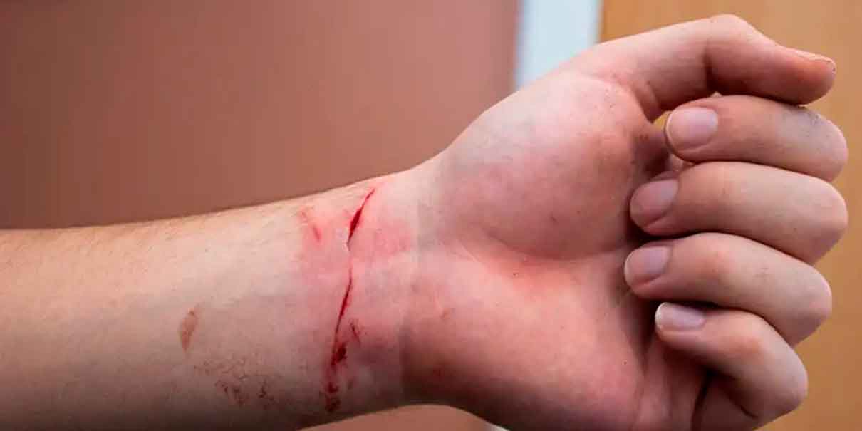 Cutting