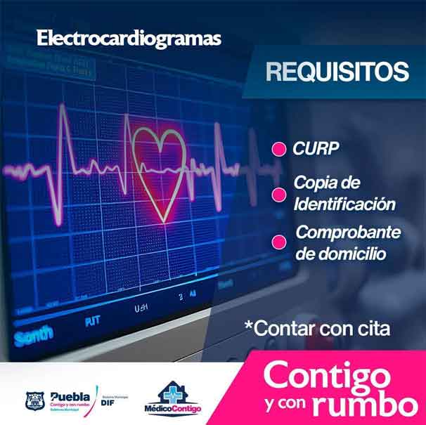 Estos son los requisitos para que te realices un electrocardiograma gratis