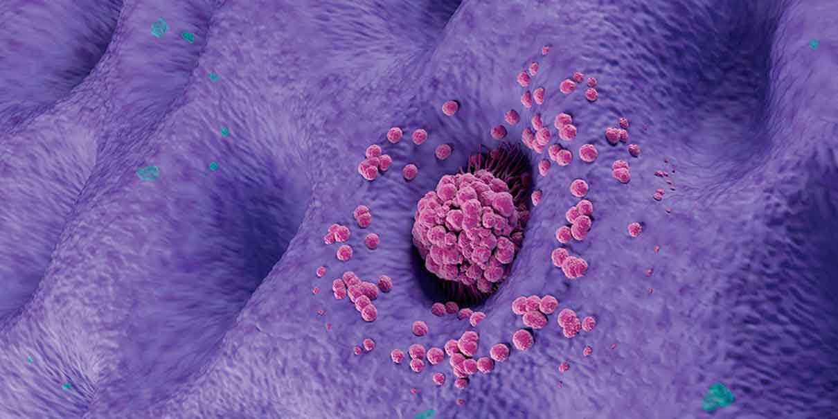 Bacteria Helicobacter pylori