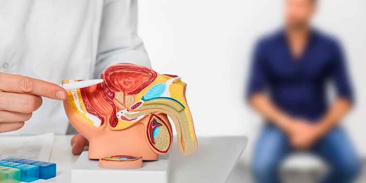 Cáncer de próstata