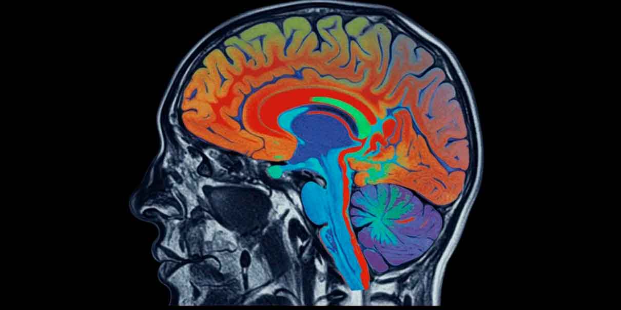 Cerebro