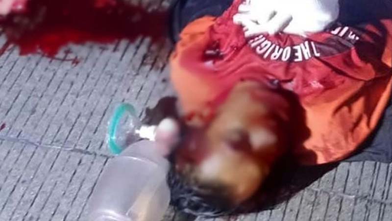 Muere joven tras brutal agresión en el bulevar Los Volcanes de Atlixco