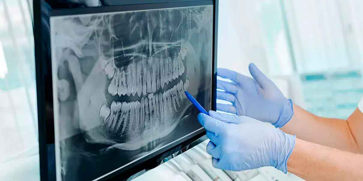 Radiografía dental