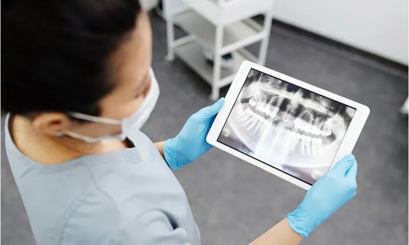 Radiografía dental