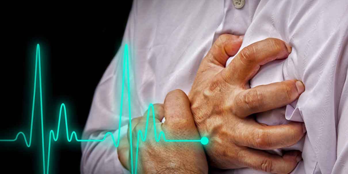 infarto