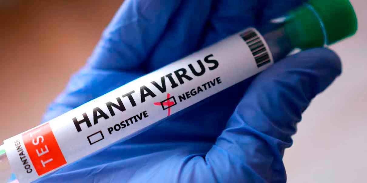 hantavirus 