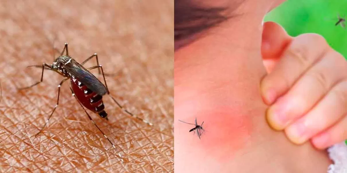 Atlixco registra un caso de dengue; el contagiado un menor de edad