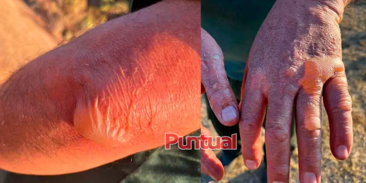 Habitantes de Tlachichuca combaten voraz incendio sin herramientas y sin apoyo 