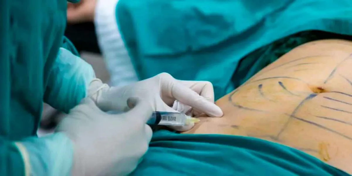 Congreso de Puebla avanza en regulación de cirugías plásticas para prevenir malas prácticas