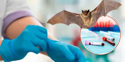 OMS mantiene al virus Nipah como amenaza prioritaria tras brote en India
