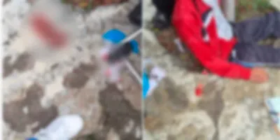 Denuncian presunto caso de bullying en Atlixco; alumno lesionado dentro de bachillerato