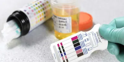 Congreso de Puebla analiza aplicar antidoping a candidatos rumbo a 2027