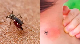 Atlixco registra un caso de dengue; el contagiado un menor de edad