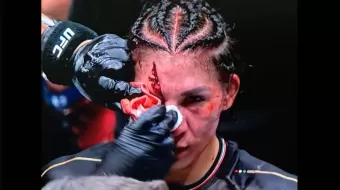 IMÁGENES SENSIBLES. Aldana sufre lesión impactante en la UFC, toda una guerrera