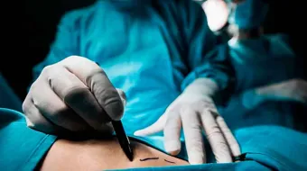 Sancionar a cirujanos no certificados y erradicar clínicas clandestinas en Puebla