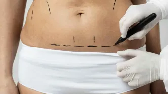 Congreso de Puebla busca frenar muertes por liposucciones mal practicadas