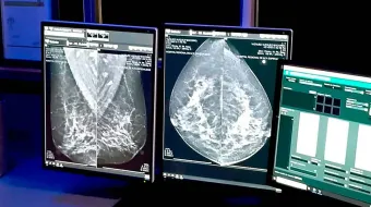 Manos Unidas contra el Cáncer: apoyo gratuito para pacientes ante el desabasto de medicamentos en México