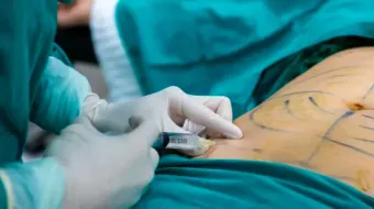 Congreso de Puebla avanza en regulación de cirugías plásticas para prevenir malas prácticas
