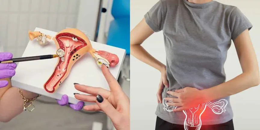 Prevención del cáncer cervicouterino: vacunación y detección temprana frente al VPH
