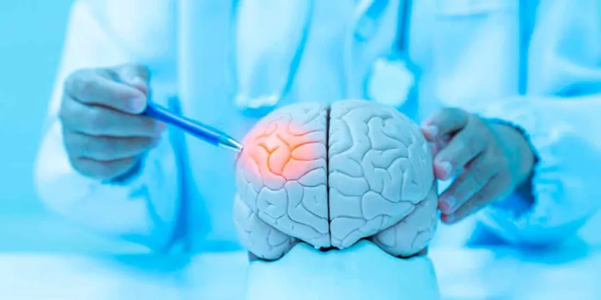Accidente cerebrovascular: factores inevitables y hábitos clave para reducir el riesgo