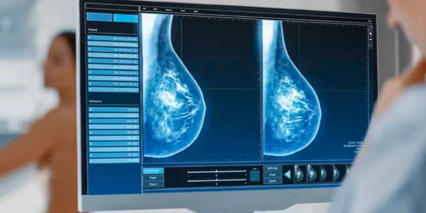 Casos de cáncer aumentarán 70% hacia 2050 si no se fortalecen las acciones de prevención: OMS